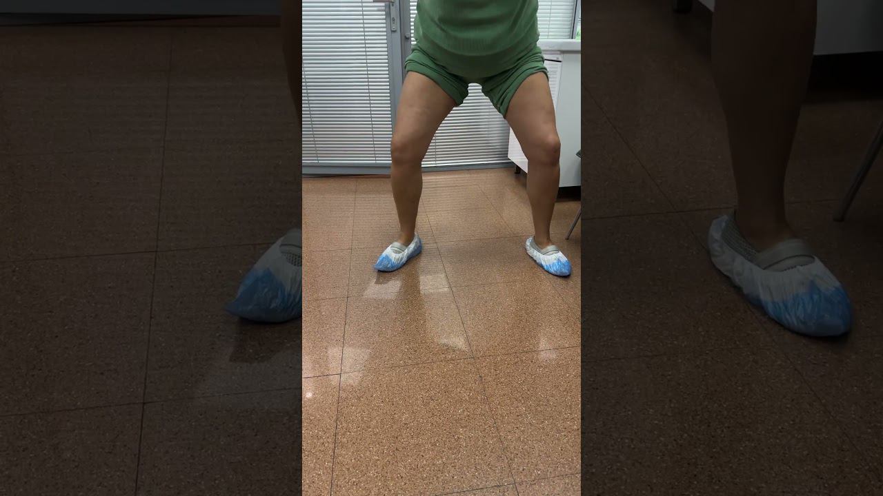 Доктор учит Приседать на Приеме | Боль в Колене после фитнеса смотреть онлайн