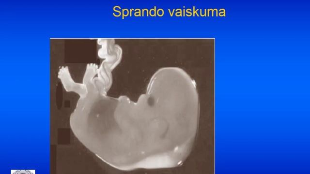 Chromosominių anomalijų patikra nėštumo metu. Doc. D. Simanavičiūtė смотреть онлайн