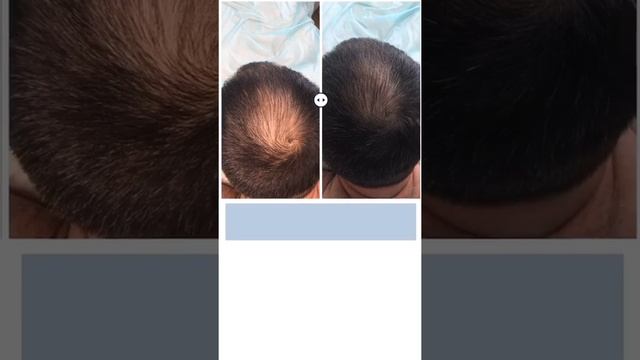 Холодная плазма (видео №5) смотреть онлайн