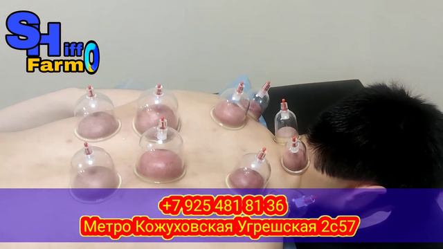 Хиджама, Хичома Дар масква шиФфо фармо, шиФфо Хичома смотреть онлайн