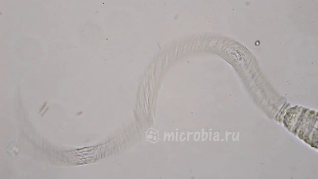 Cercaria(swimmer's Itch Cause)/ Церкария, вызывающая зуд купальщика