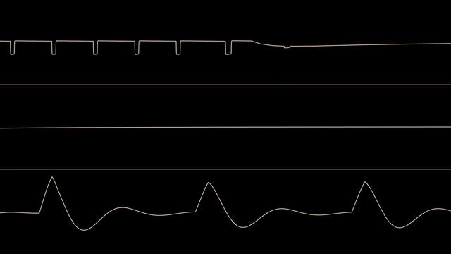 DRAX - "Omniphunk" / C64 Oscilloscope Visualization смотреть онлайн