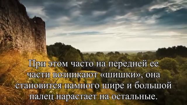 Чем опасны угги, балетки и обувь на шпильках — Статья смотреть онлайн