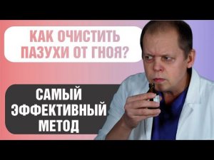 Как лечить гайморит без прокола и очистить пазухи носа?
