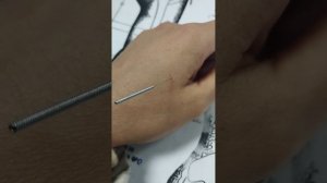 Точка хэгу от ста болезней #иглотерапия #иглоукалывание