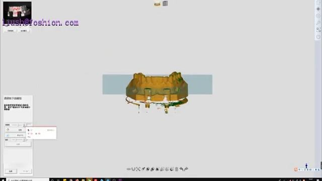 dental veneer scanning смотреть онлайн