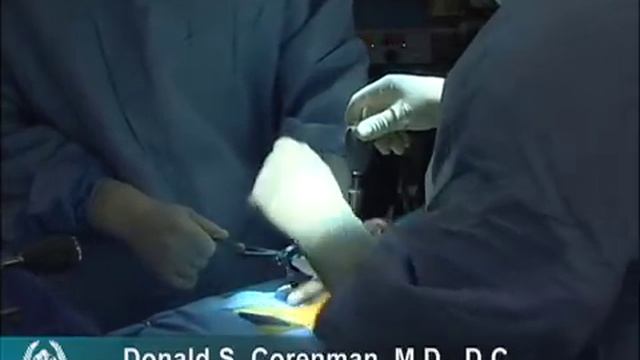 L5 S1 Fusion | TLIF Back Surgery Video | O Arm CT| Vail Colorado смотреть онлайн