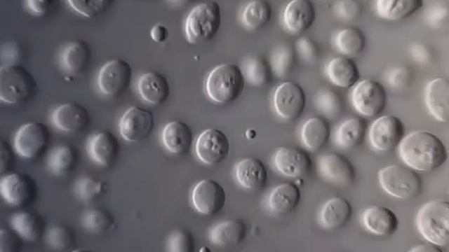 Fungi - Jamur Ascomycota смотреть онлайн