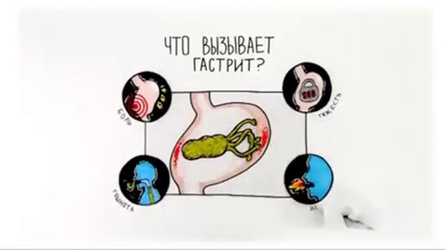 Фосфалюгель и Де-Нол смотреть онлайн