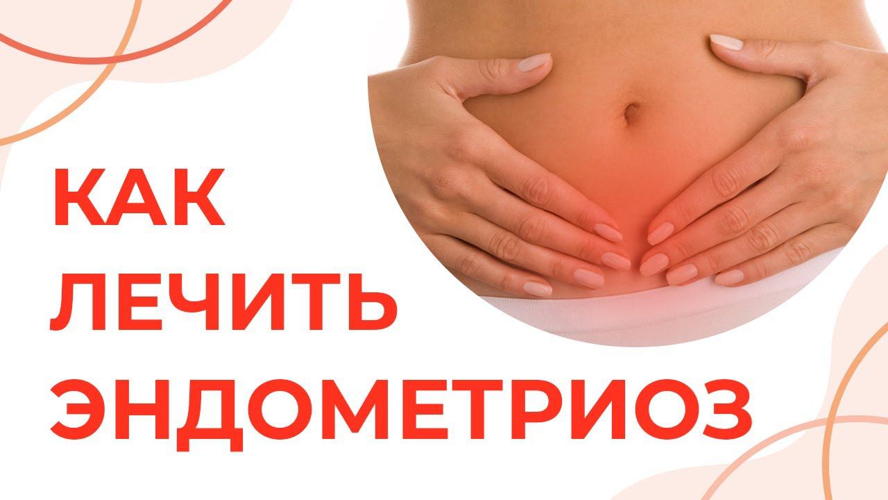 Как лечить эндометриоз | Баданова С.Г. смотреть онлайн