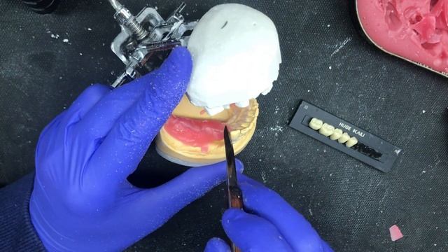 Ацеталовый протез | Protesis flexbiles acetal смотреть онлайн