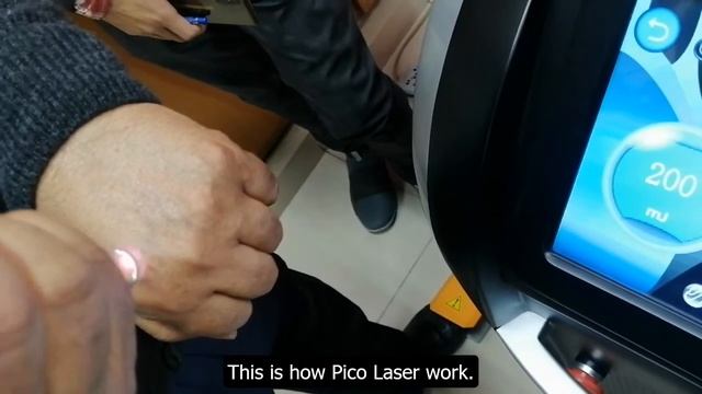 Removing Tattoos With Picolaser Machines | A Revolutionary Breakthrough | Demonstration L #picolase