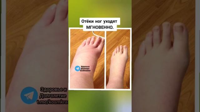 отёки ног уходят мгновенно #здоровье #зож #народнаямедицина #долголетие #народныерецепты смотреть онлайн