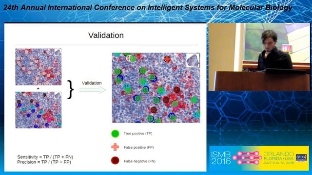 CD30 cell graphs of Hodgkin lymphoma are not scale-free—an... - Tim Schäfer - Highlights - ISMB 201 смотреть онлайн
