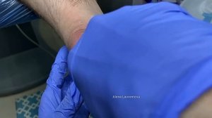 Самые сложные ноги / Кератоз пяток / Огрубевшие пятки / Трещины на пятках / Педикюр