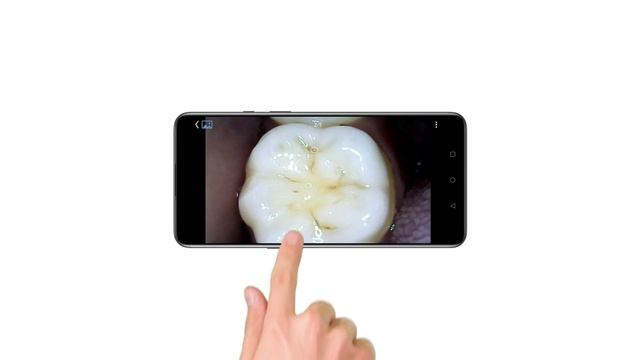 How to use IntraOral Camera | Orkki IntraOral Camera With WiFi смотреть онлайн