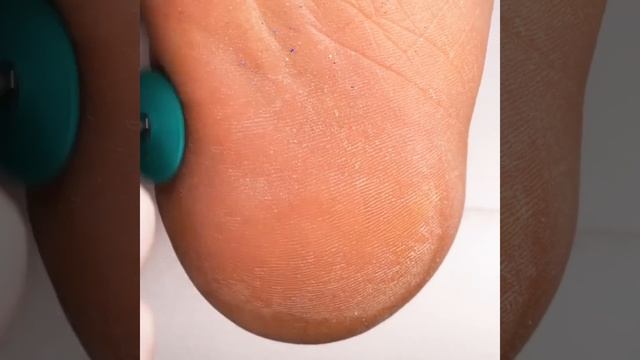 ГЕНИАЛЬНЫЕ ИДЕИ С ОБУВЬЮ И ЛАЙФХАКИ УХОДА ЗА СТУПНЯМИ смотреть онлайн