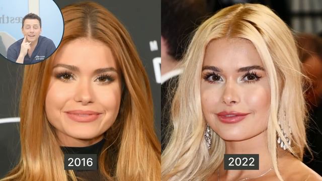 PAMELA REIF – die VERÄNDERUNG der Fitness Influencerin – doc.rolf reagiert смотреть онлайн