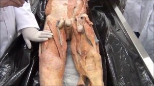 Топография нижней конечности. Мышцы.