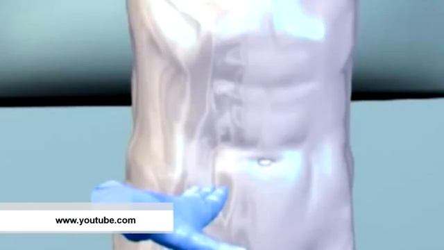 Рубрика "PRO здоровье": аппендикс смотреть онлайн