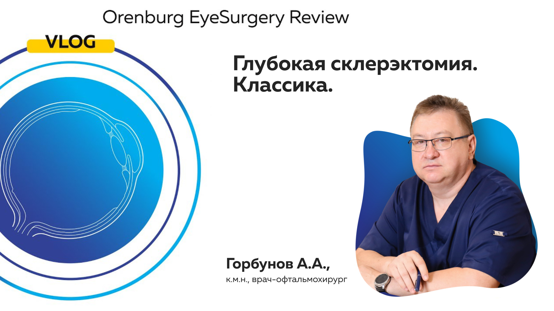 Глубокая склерэктомия. Классика