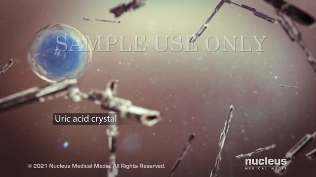 Gout смотреть онлайн