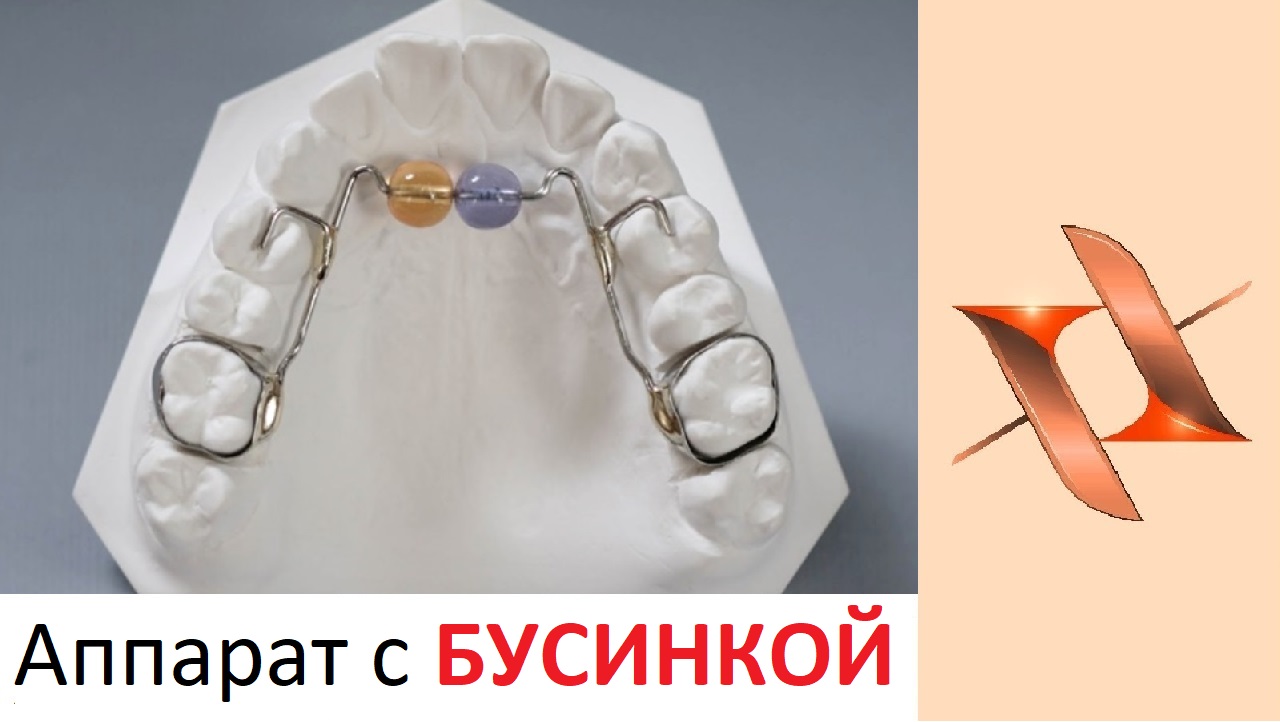 Аппараты с 