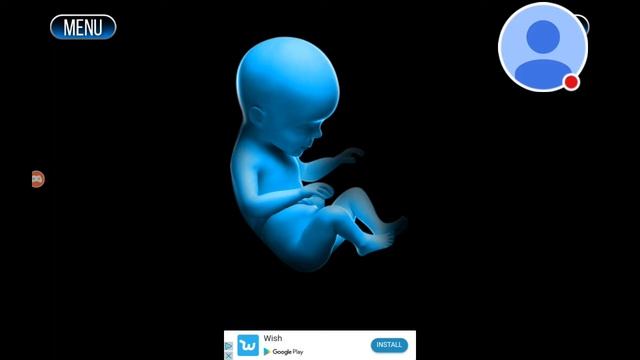 My Xray Scanner Pregnant Prank Stream смотреть онлайн