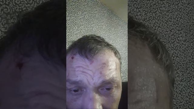 Видео Камеры В Глазах 127устап От Этой Боли смотреть онлайн