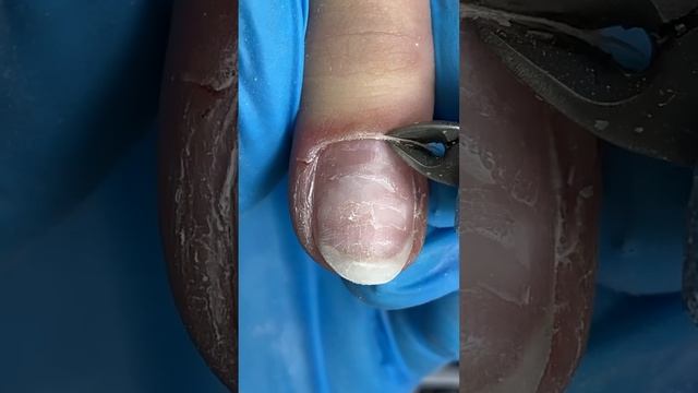 Огромная заусеница… смотреть онлайн