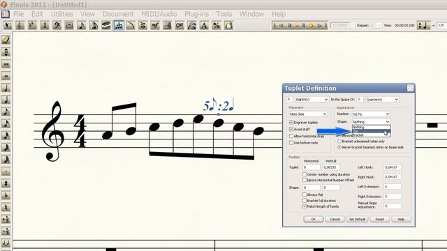 Finale 2012 для чайников. Урок 16  - Tuplet (инструмент 