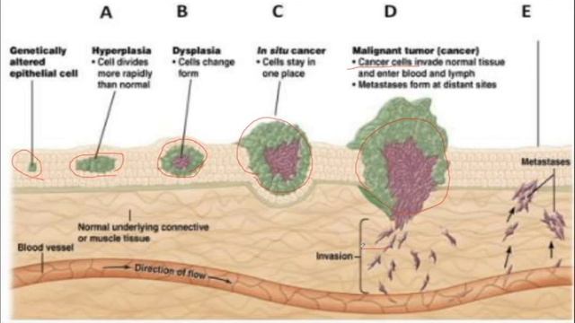 سرطان چیست قسمت اول What is Cancer Part one смотреть онлайн