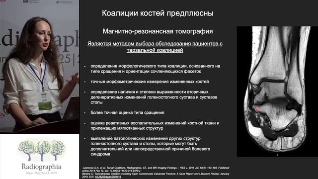 Ирина Менькова. Варианты строения и аномалии структур голеностопного сустава и заднего отдела стопы смотреть онлайн