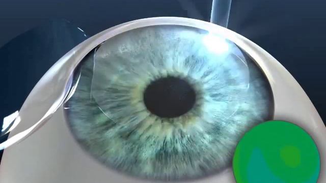 Star S4 IR Advanced CustomVue Animation смотреть онлайн