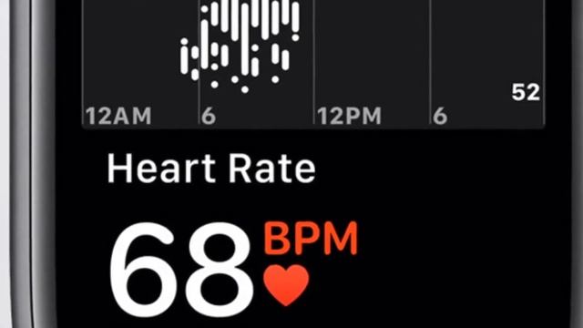 AN EVEN BETTER APPLE WATCH FOR SENIORS. WHY OLDER PEOPLE NEED AN APPLE WATCH SE NOW Apple Watch SE. смотреть онлайн