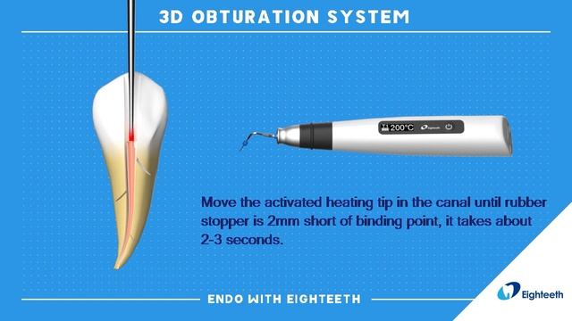 How To Use Eighteeth Obturation System Fast-Pack Fast-Fill Continuous Wave Compaction WVC