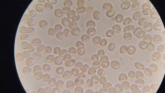 Кровь после масла и семян чёрного тмина смотреть онлайн