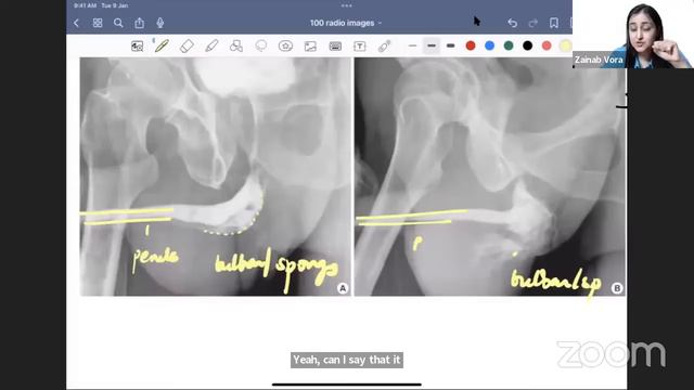 Thank God It's Friday - Top 100 Radiology Images by Dr. Zainab Vora | Cerebellum Academy смотреть онлайн