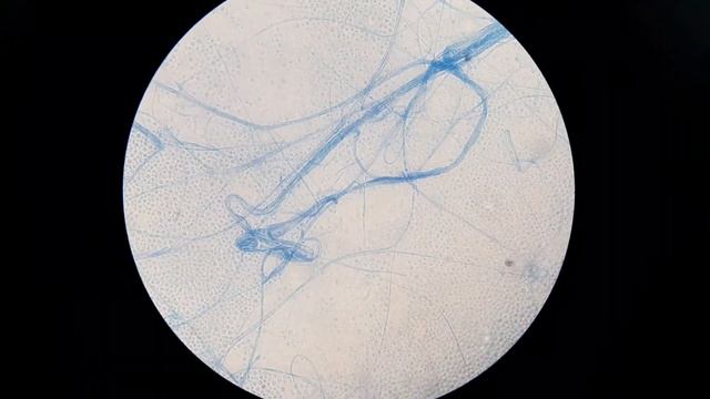 Fungal spores, hyphae and mycelium in LPCB mount Microscopy at various magnifications смотреть онлайн