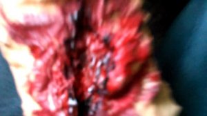 Порез на руце