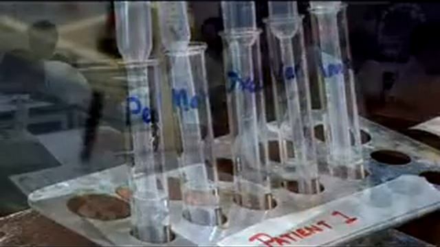 e-Bug school activities to teach about antibiotics and antibiotic resistance смотреть онлайн