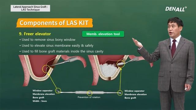 master courseM SURGERY Lateral Approach Sinus Graft LAS Technique смотреть онлайн