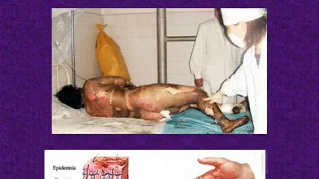 ожег 1 смотреть онлайн