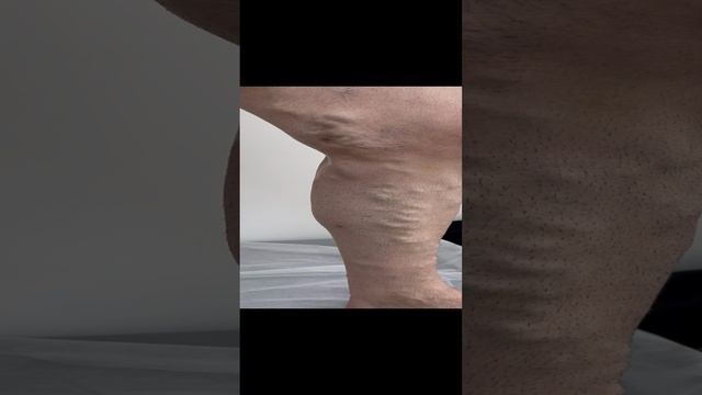 Флеболог Москва Сардар Алиханов