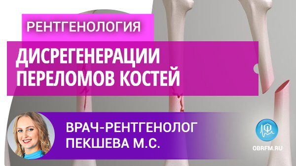 Врач-рентгенолог Пекшева М.С.: Дисрегенерации переломов костей смотреть онлайн