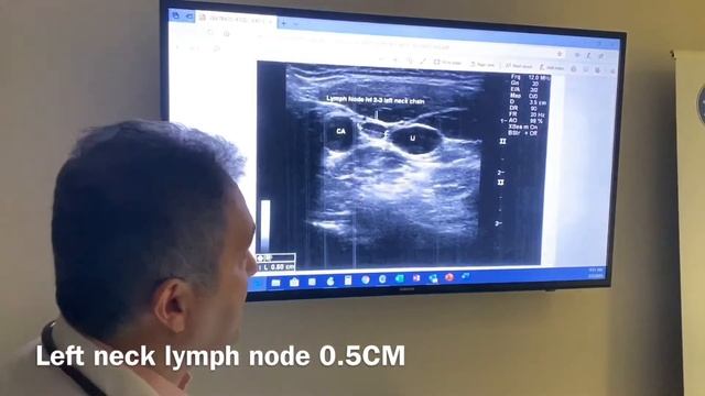 Sean Nikravan MD, Thyroid Cancer and Lymph nodes neck surveillance follow up. смотреть онлайн