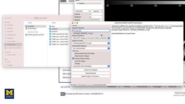 MRIcroGL Tutorial #2: Converting DICOM to NIFTI смотреть онлайн