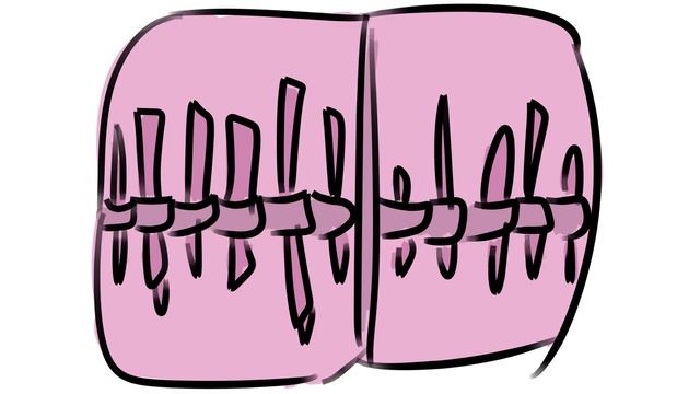 Ты что, поломанная ручка? КуроНиколь 13 карт Куромаку Николь смотреть онлайн