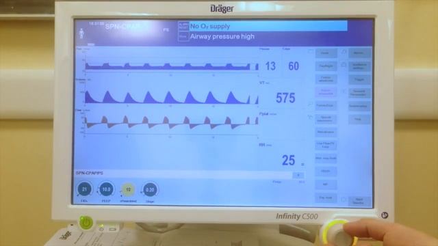 p0.1 during pressure support ventilation on a Draeger Infinity V500 смотреть онлайн