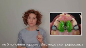 Несъемная пластинка Хаас. Плюсы и минусы.